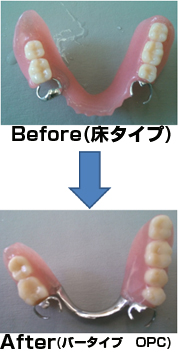 アクリルジェット